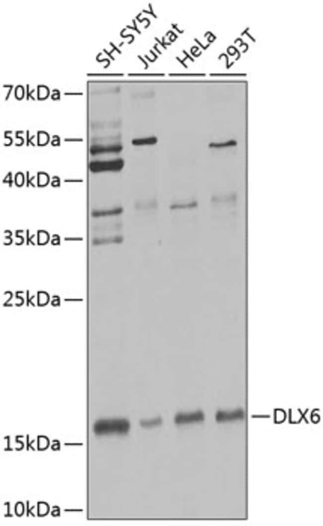 100UL DLX6 ANTIBODY 100 ul