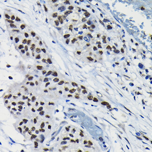 100UL DRIL1 ANTIBODY 100 ul