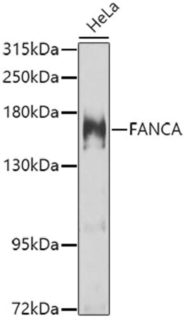 100UL FANCA ANTIBODY 100 ul