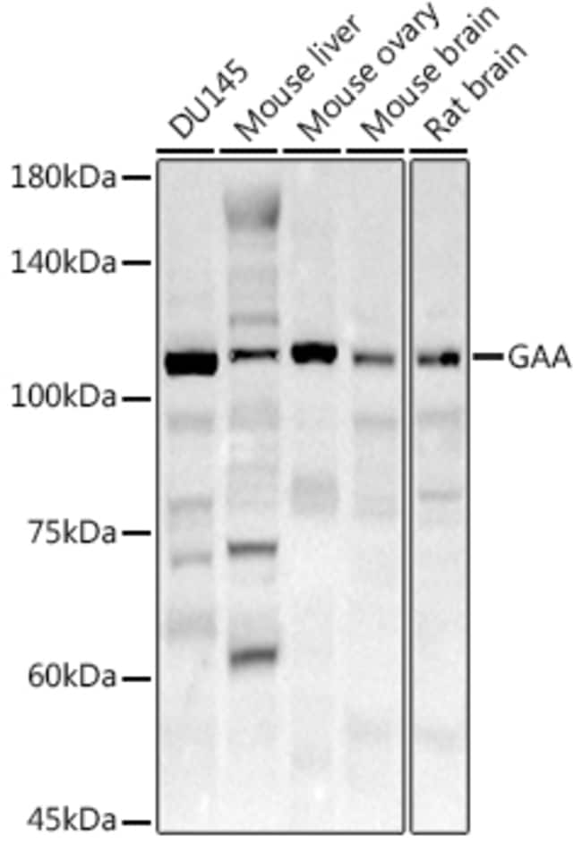 100UL GAA ANTIBODY 100 ul