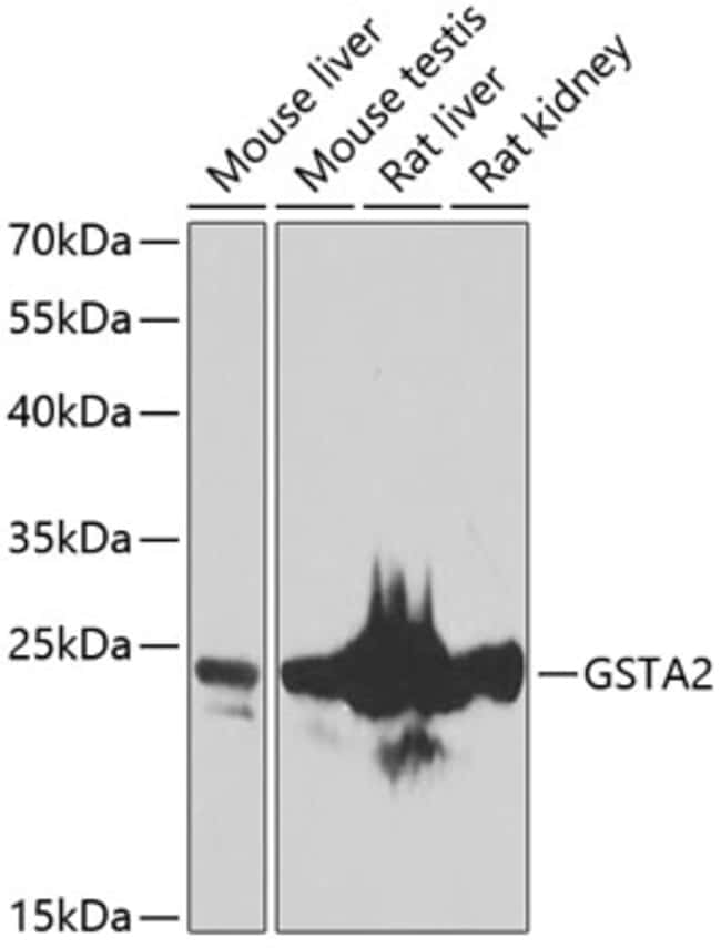 100UL GSTA2 ANTIBODY 100 ul