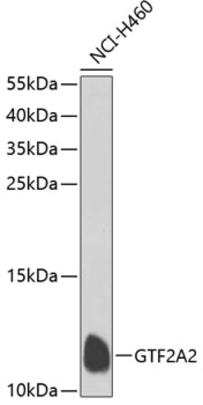 100UL GTF2A2 ANTIBODY 100 ul