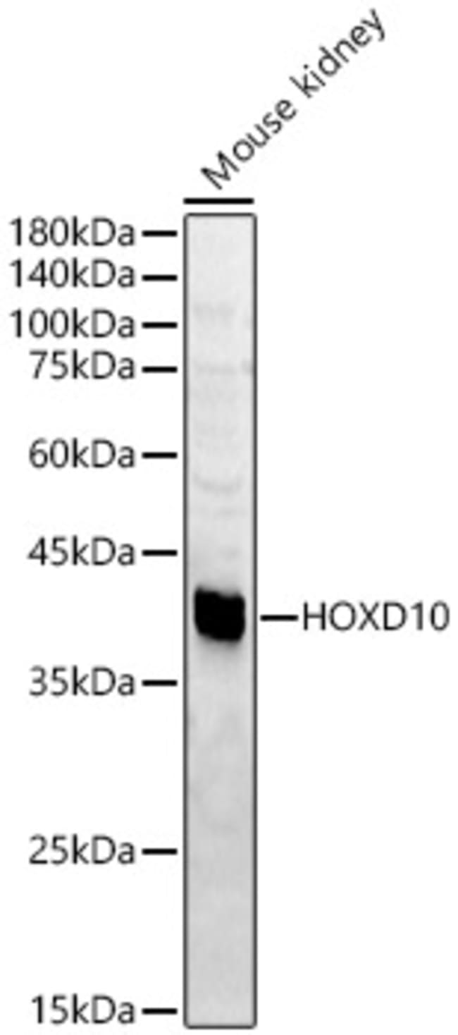 100UL HOXD10 ANTIBODY 100 ul