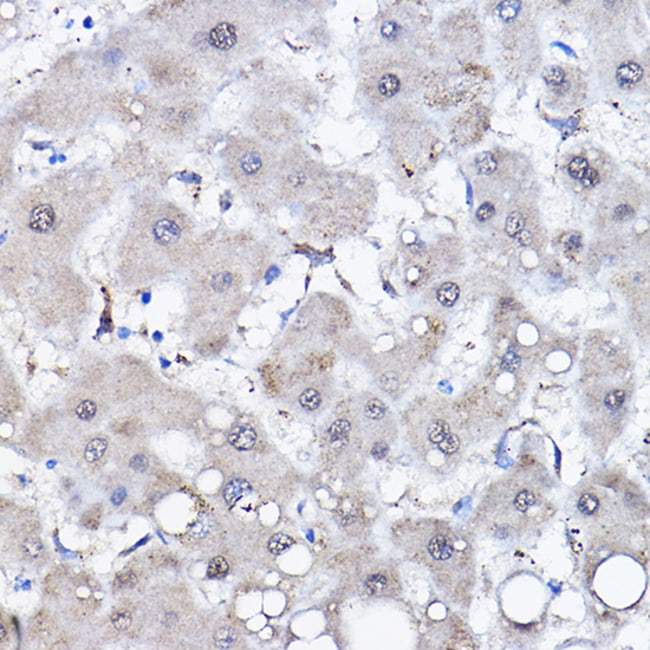 100UL HSPA6 ANTIBODY 100 ul