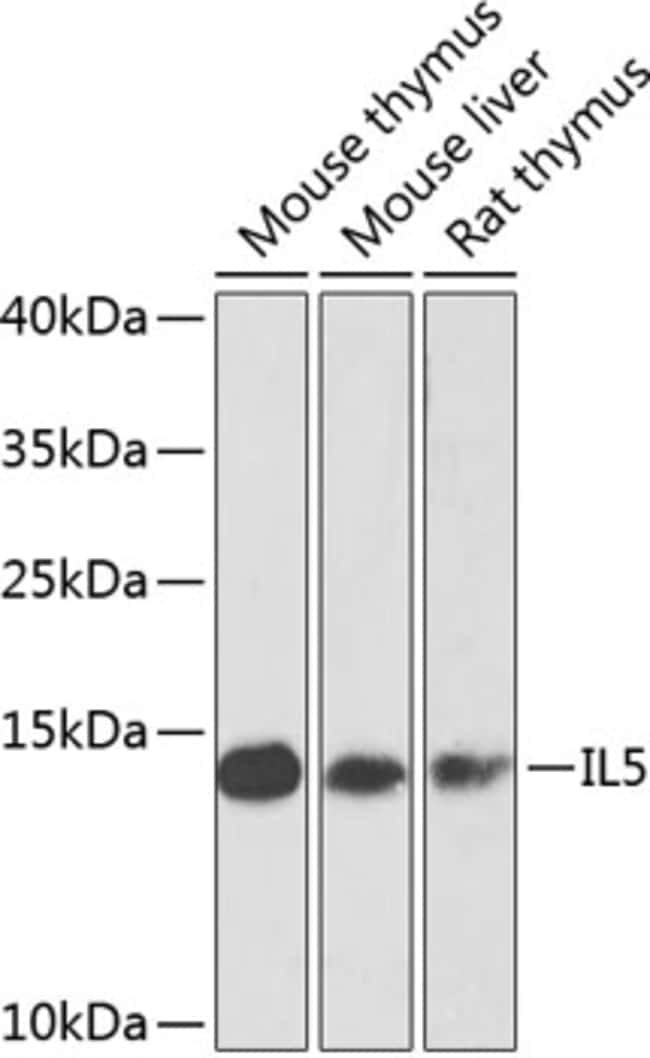100UL IL-5 ANTIBODY 100 ul