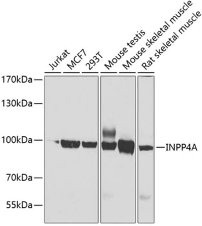 100UL INPP4A ANTIBODY 100 ul