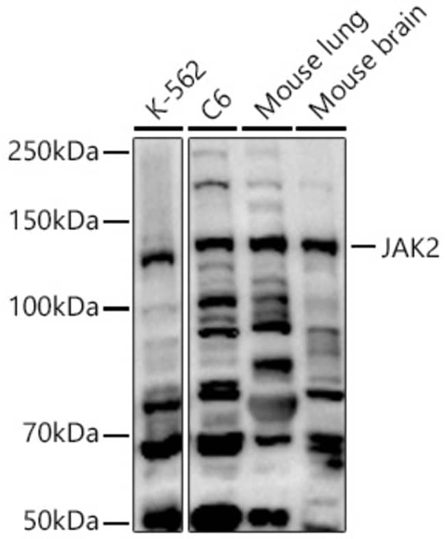 100UL JAK2 ANTIBODY 100 ul
