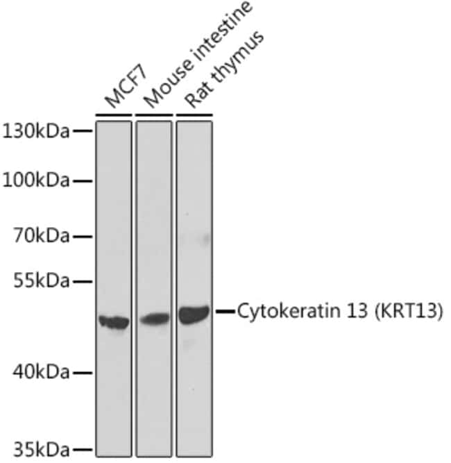 100UL CYTOKERATIN 13 ANTIBODY 100 ul