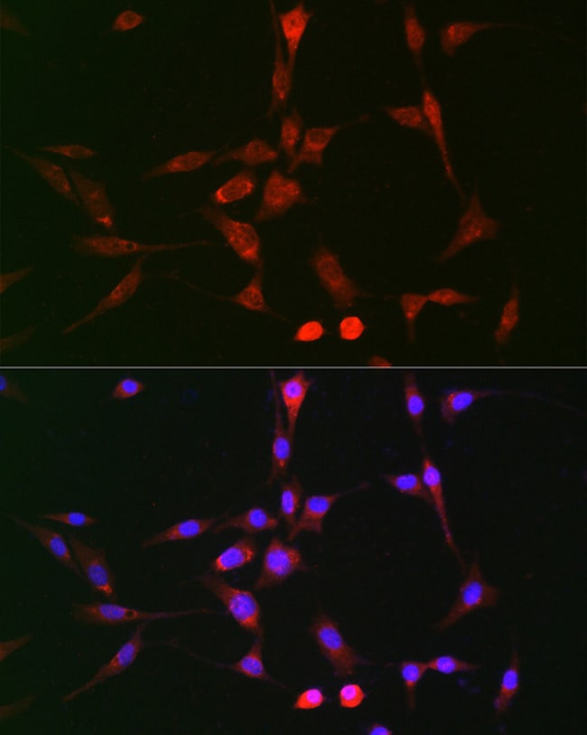 100UL LOX ANTIBODY 100 ul