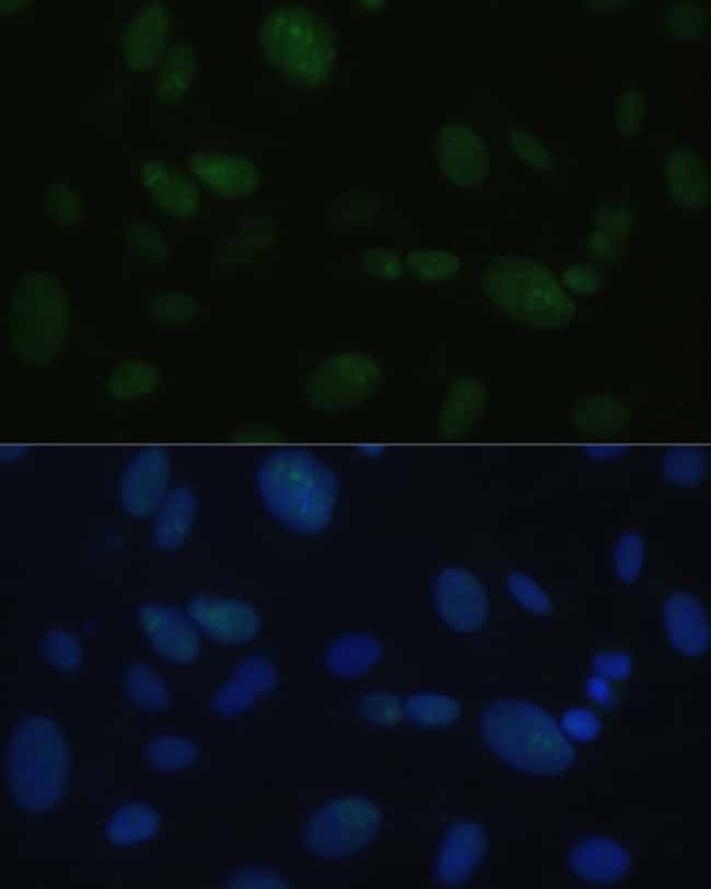 100UL DNA-PK ANTIBODY 100 ul