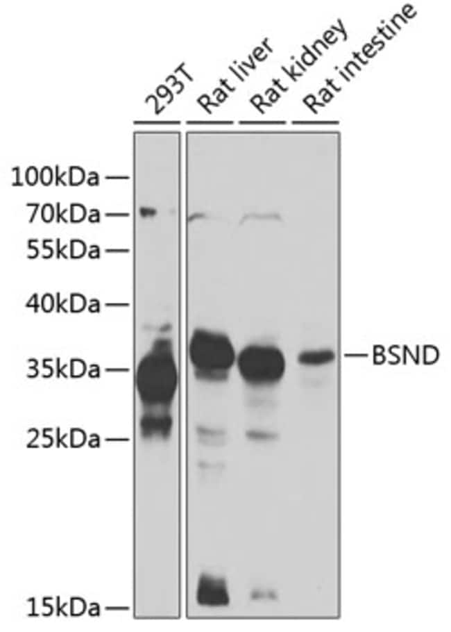 100UL BSND ANTIBODY 100 ul