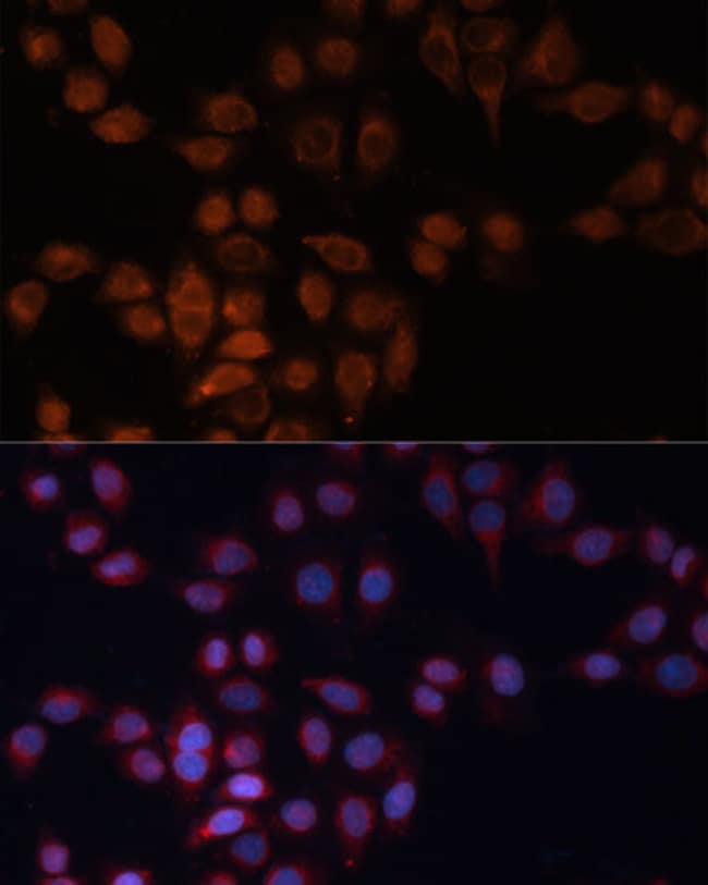 100UL ADAM15 ANTIBODY 100 ul