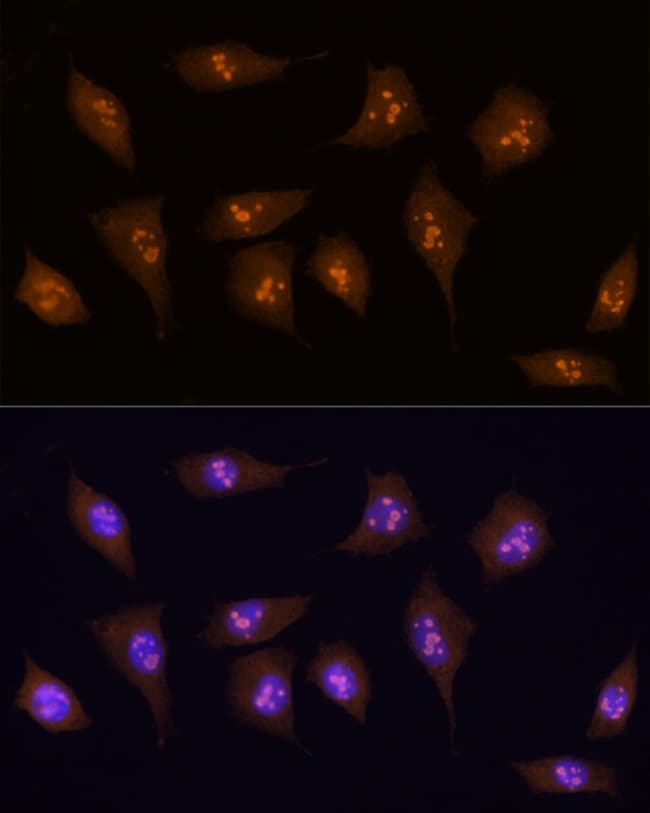 100UL KDM5B ANTIBODY 100 ul