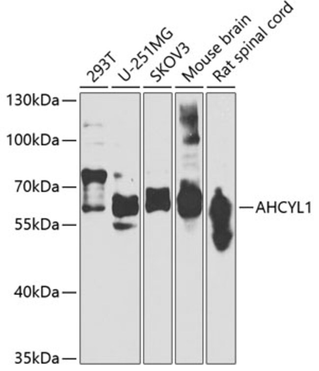 100UL ADOHCYASE 2 ANTIBODY 100 ul