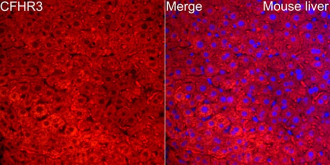 100UL CFHR3 ANTIBODY 100 ul