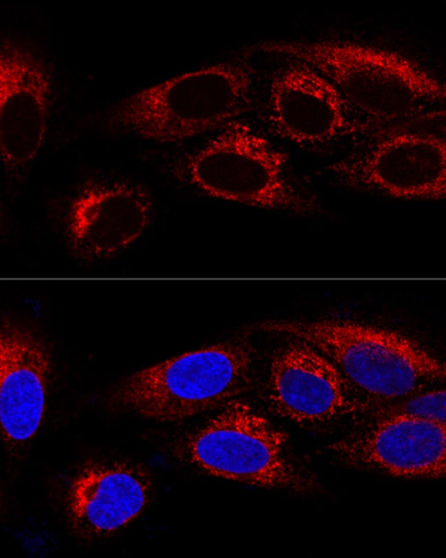 100UL CKAP4 ANTIBODY 100 ul