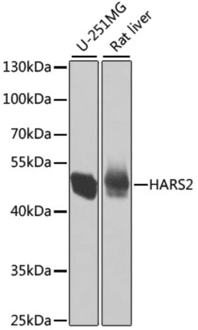 100UL HARS2 ANTIBODY 100 ul