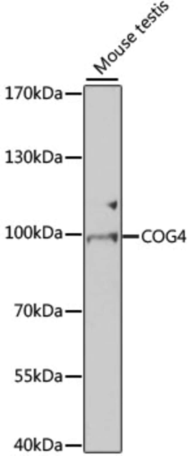 100UL COG4 ANTIBODY 100 ul