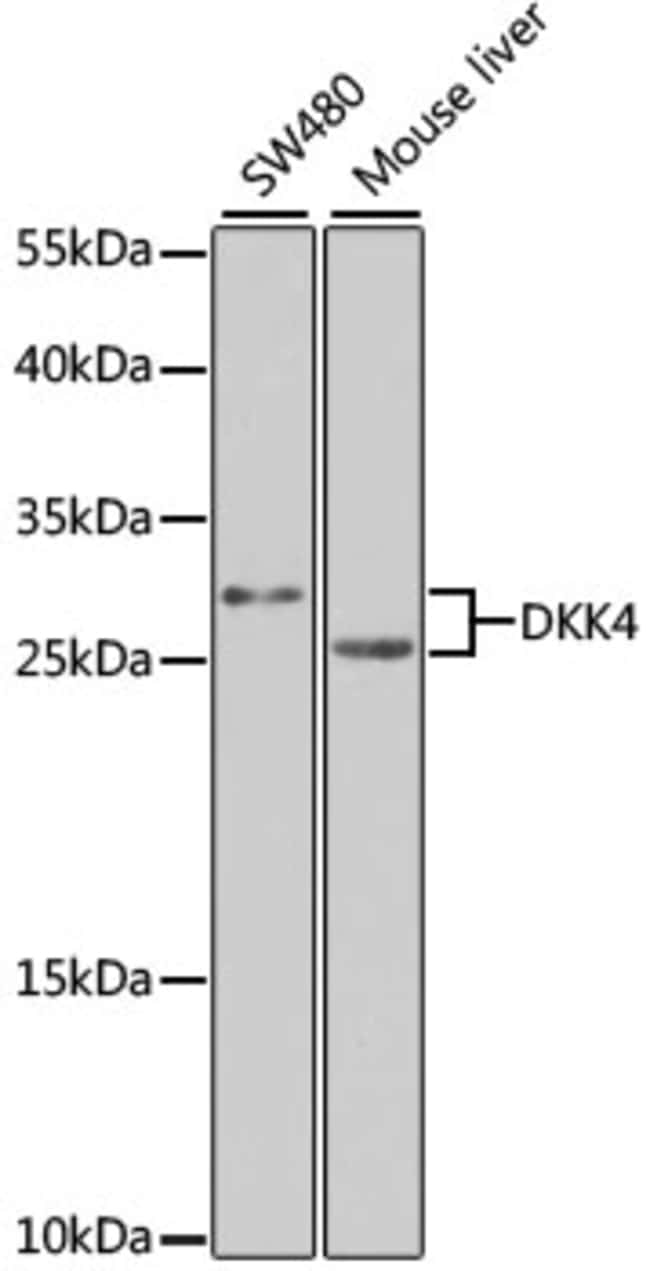 100UL DKK4 ANTIBODY 100 ul