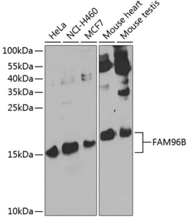 100UL FAM96B ANTIBODY 100 ul
