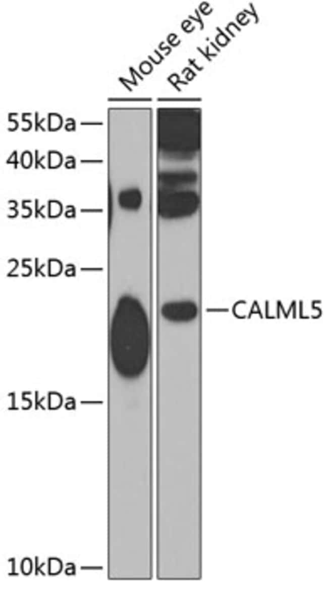 100UL CALML5 ANTIBODY 100 ul