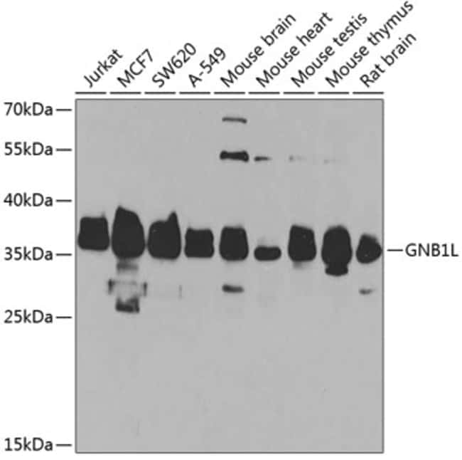 100UL GNB1L ANTIBODY 100 ul