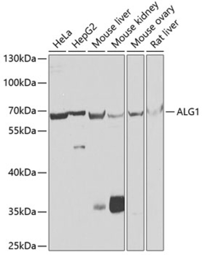 100UL ALG1 ANTIBODY 100 ul