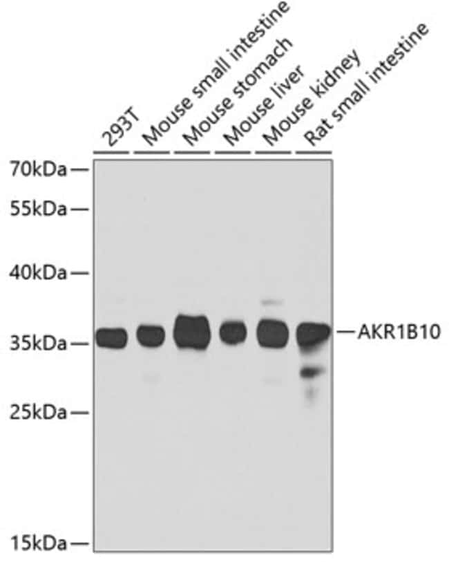 100UL AKR1B10 ANTIBODY 100 ul
