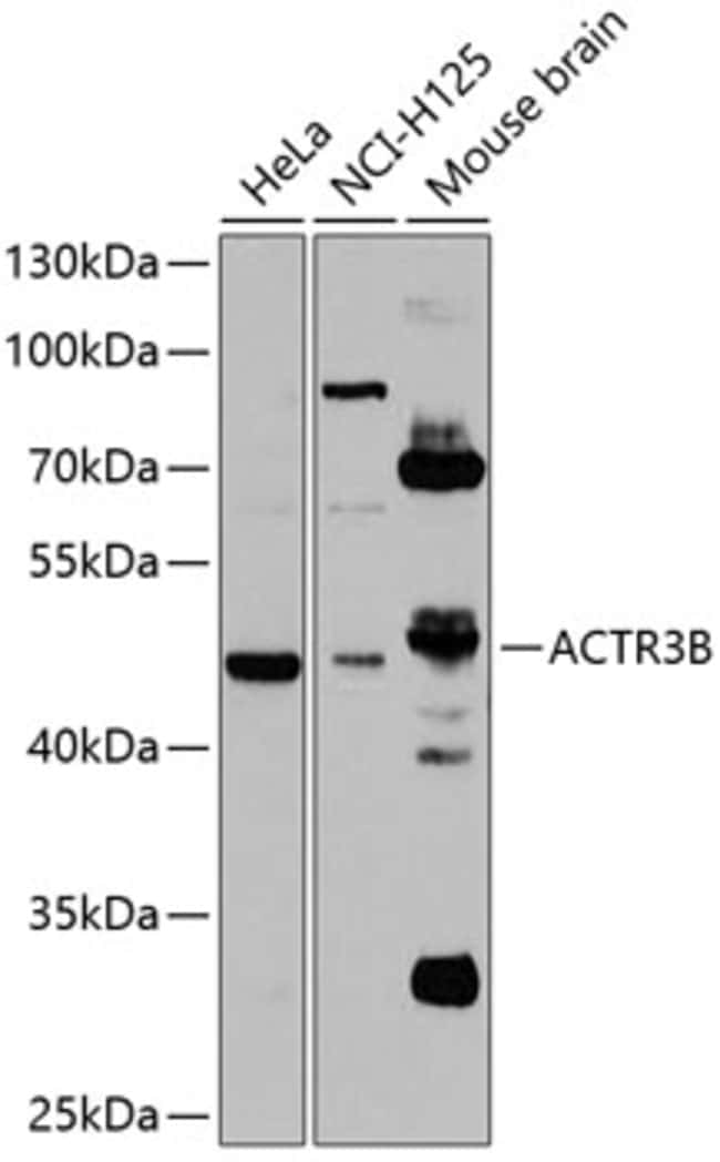 100UL ACTR3B ANTIBODY 100 ul
