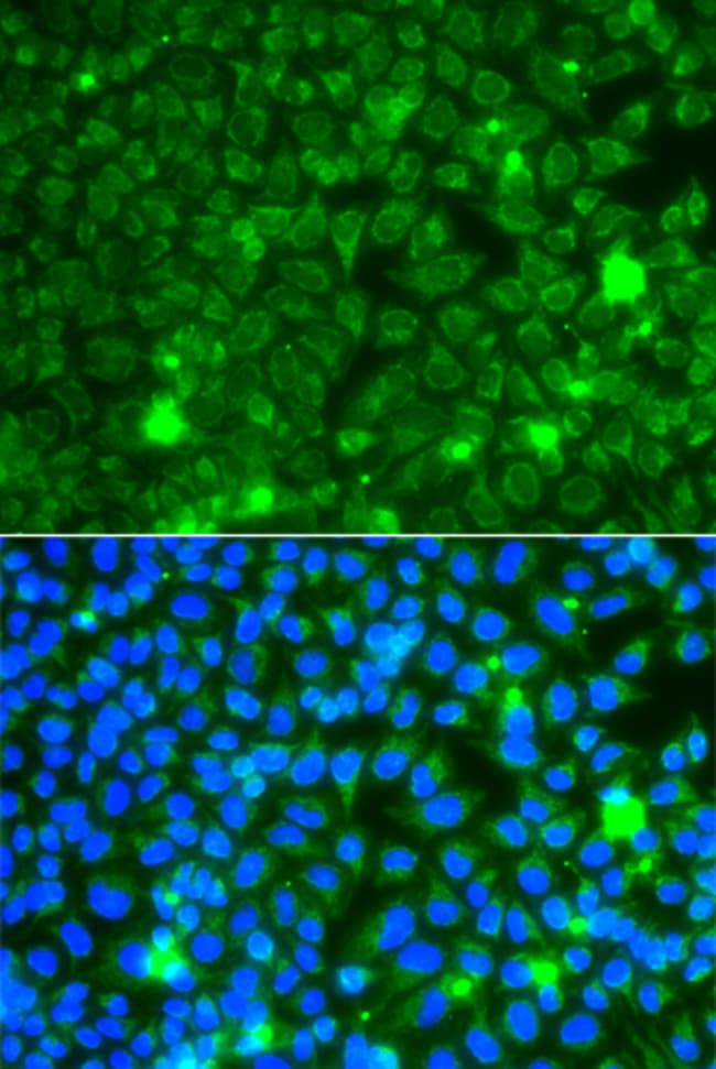 100UL GBA3 ANTIBODY 100 ul