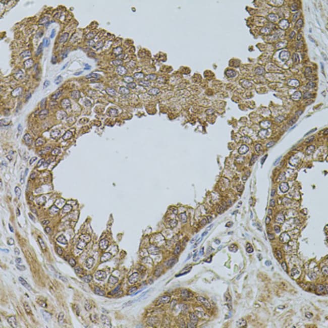 100UL CHRFAM7A ANTIBODY 100 ul