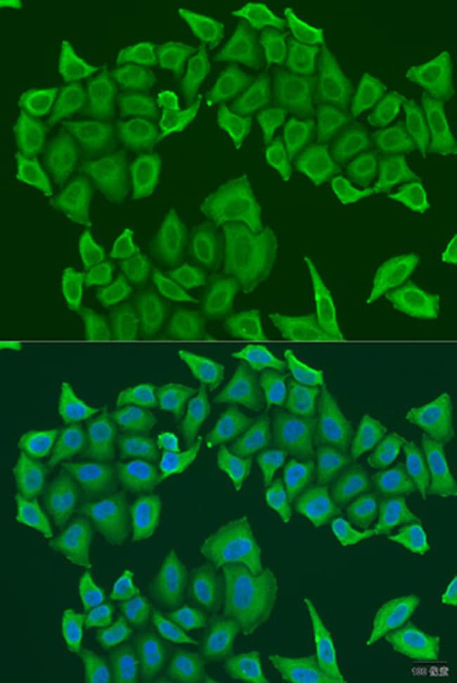 100UL HICE1 ANTIBODY 100 ul