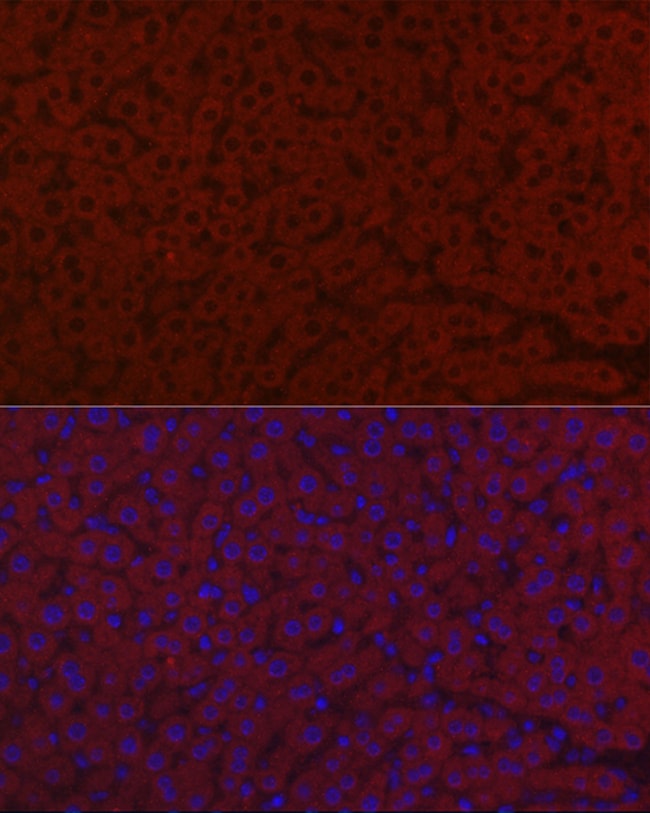 100UL LRG1 ANTIBODY 100 ul