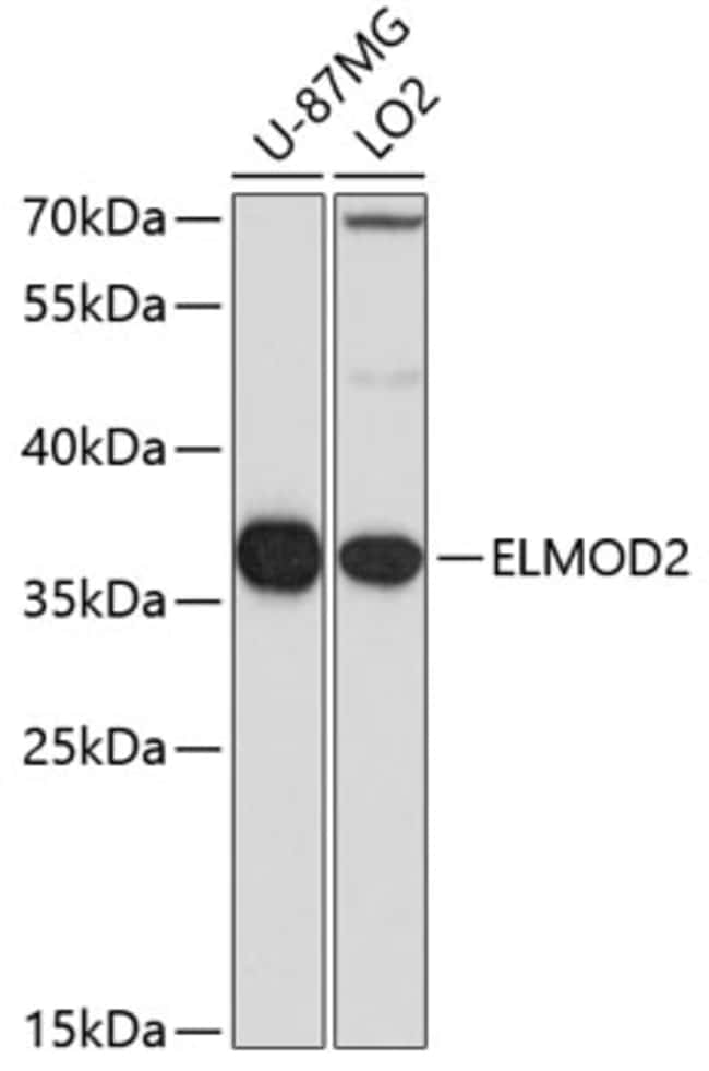 100UL ELMOD2 ANTIBODY 100 ul