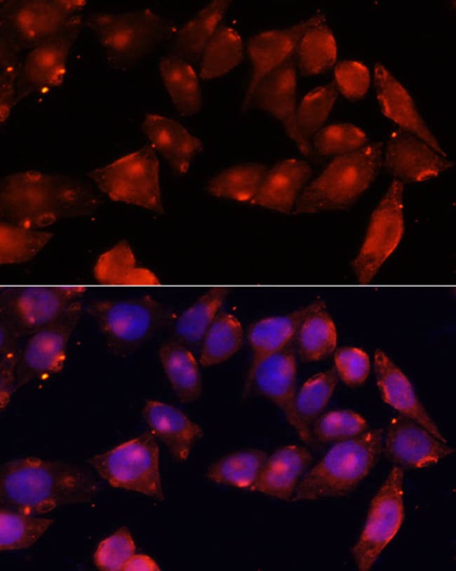 100UL ACVR2B ANTIBODY 100 ul