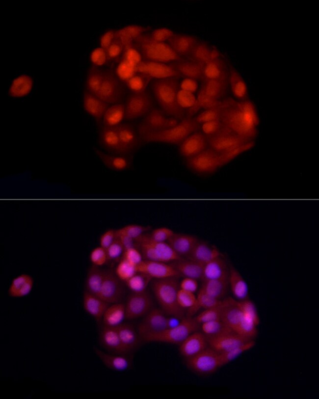 100UL ADAR ANTIBODY 100 ul