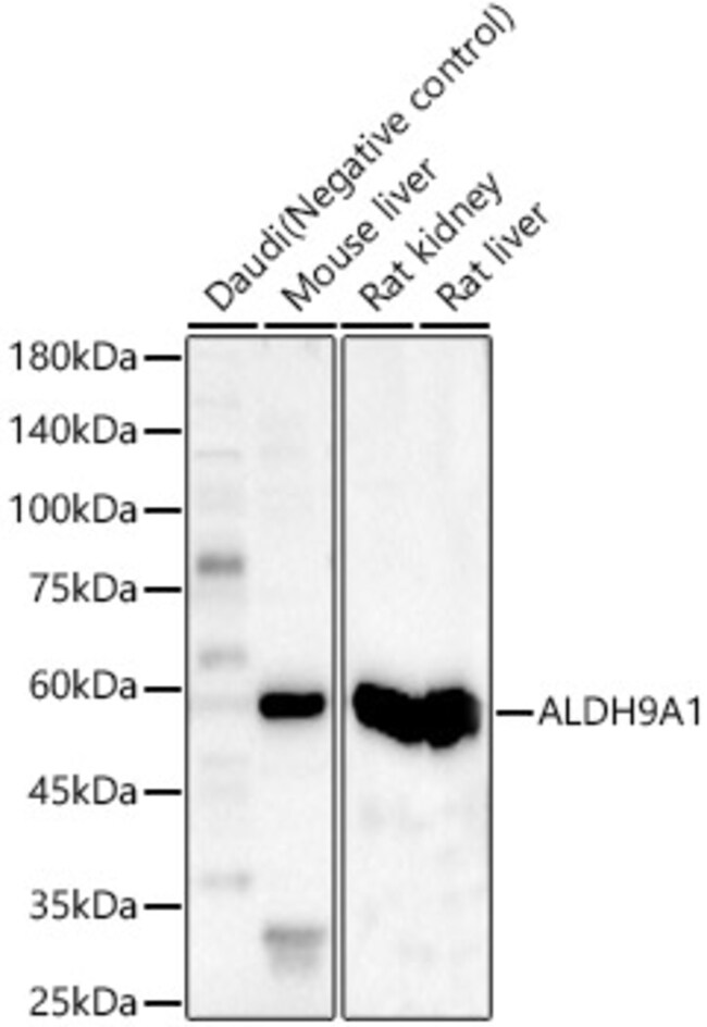 100UL ALDH9A1 ANTIBODY 100 ul