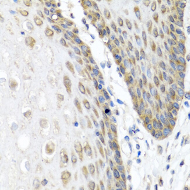 100UL ANGIOPOIETIN 1 ANTIBODY 100 ul