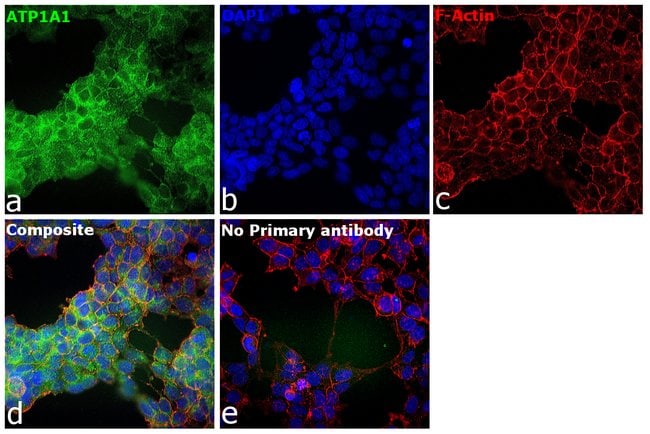 100UL ATP1A1 ANTIBODY 100 ul