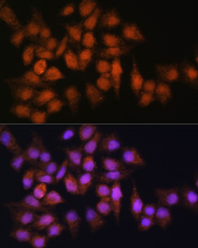 100UL BISPHOSPHOGLYCERATE MUTASE ANT 100