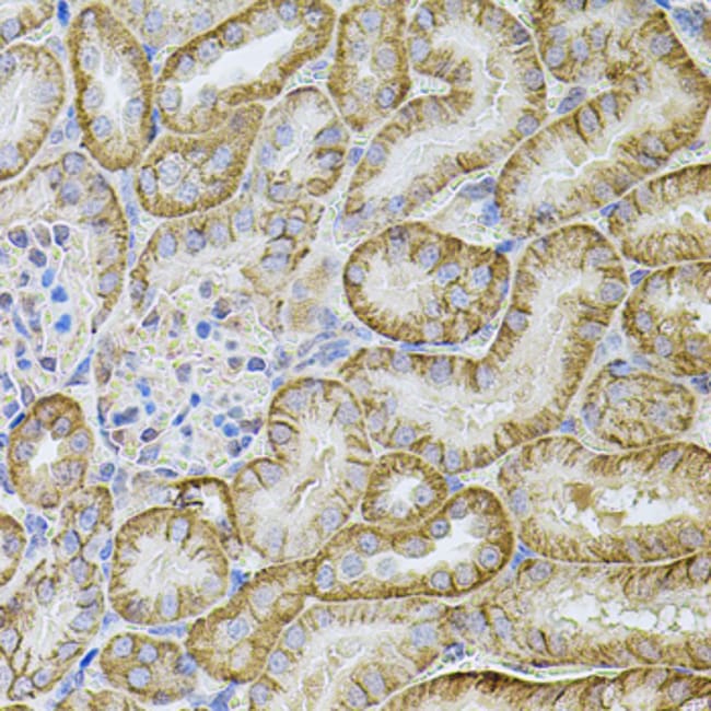 100UL CDH16 ANTIBODY 100 ul