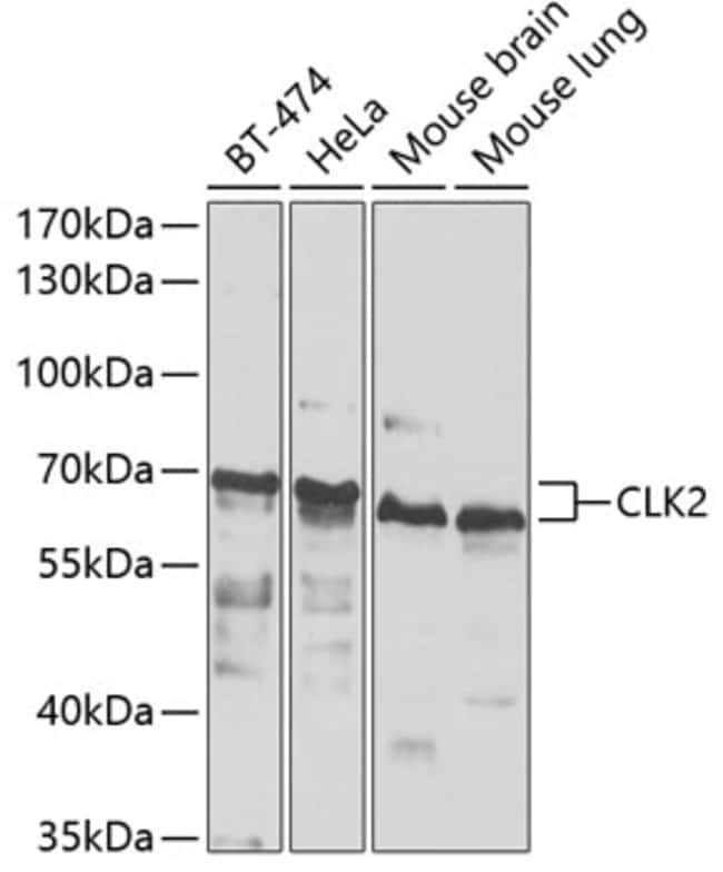 100UL CLK2 ANTIBODY 100 ul