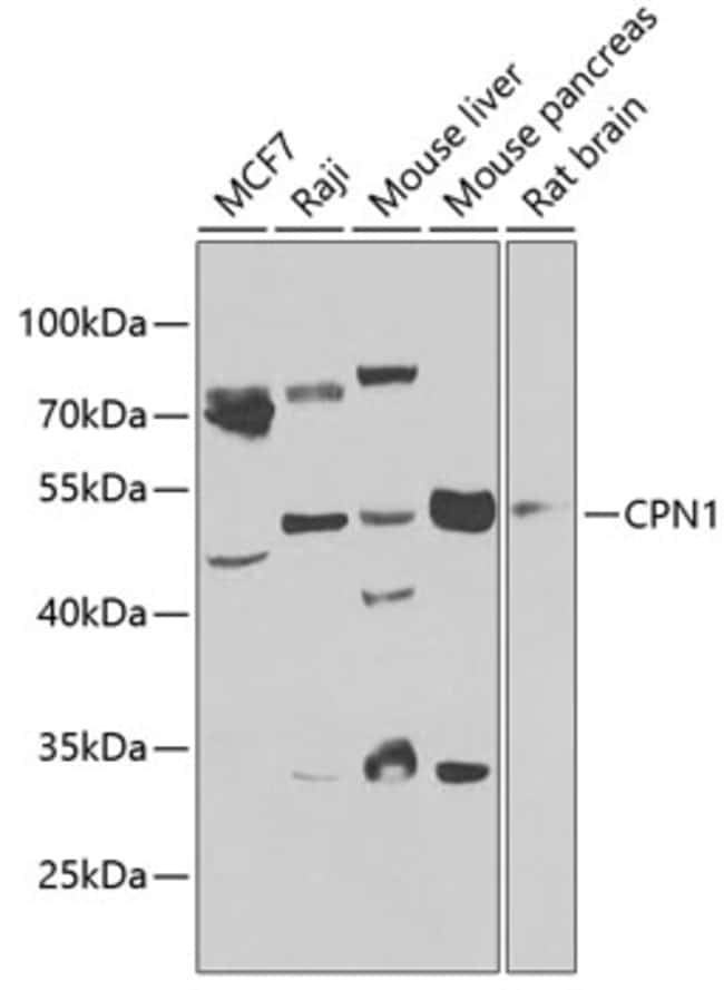 100UL CPN1 ANTIBODY 100 ul