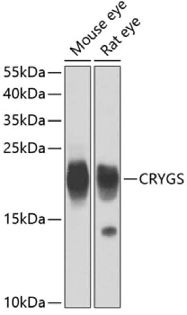 100UL CRYGS ANTIBODY 100 ul