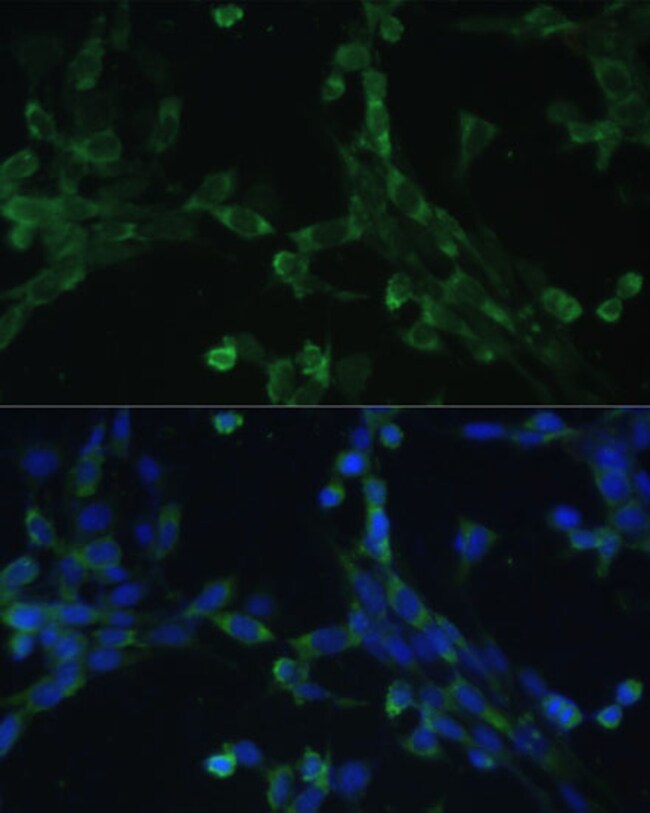 100UL EEF1G ANTIBODY 100 ul