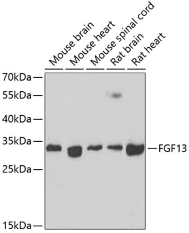 100UL FGF13 ANTIBODY 100 ul