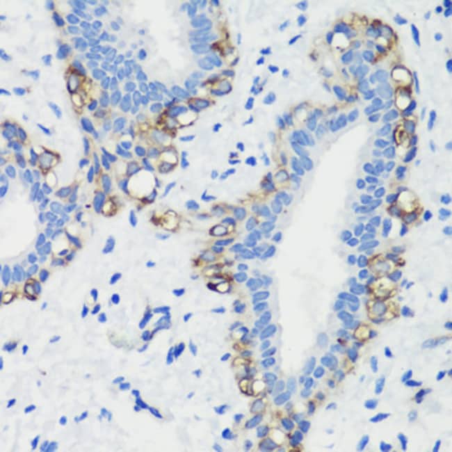 100UL FILAMIN A ANTIBODY 100 ul