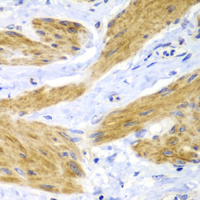 100UL H-RAS ANTIBODY 100 ul