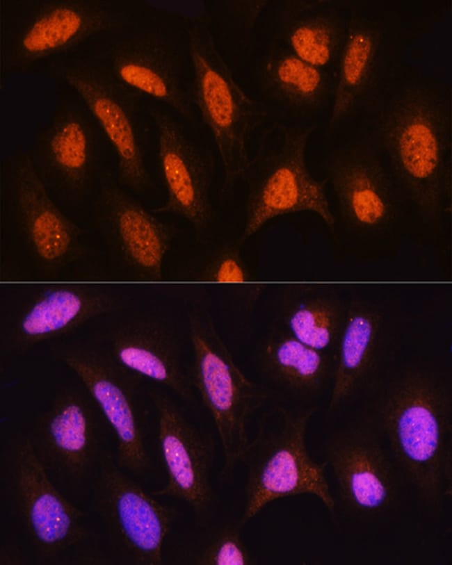 100UL HSPA2 ANTIBODY 100 ul