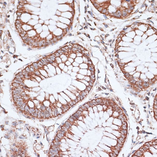 100UL KCNS3 ANTIBODY 100 ul